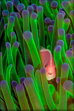 Honorable Mention: Clownfish with tongue parasite by Peter Allinson